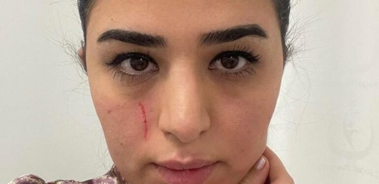 Mersin’de kadın doktora saldırı: 2 gözaltı