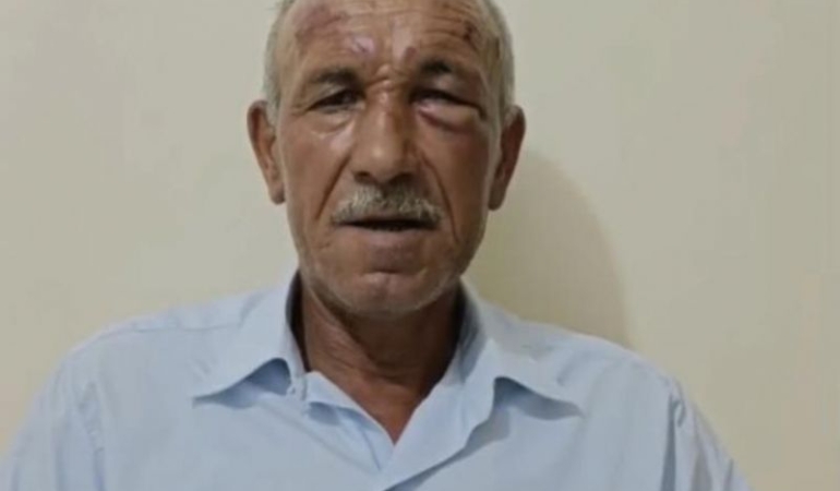 Muhtara saldırı olayında 2 şüpheli tutuklandı